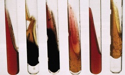 Triple Sugar Iron Agar test, TSIA